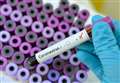 Latest data shows number of coronavirus deaths in area