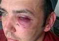 Manea father and son sentenced for attack