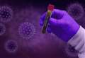 Coronavirus: how many people have tested positive in Cambridgeshire?