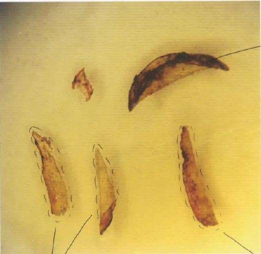 Clippings taken from Una Crown’s left hand