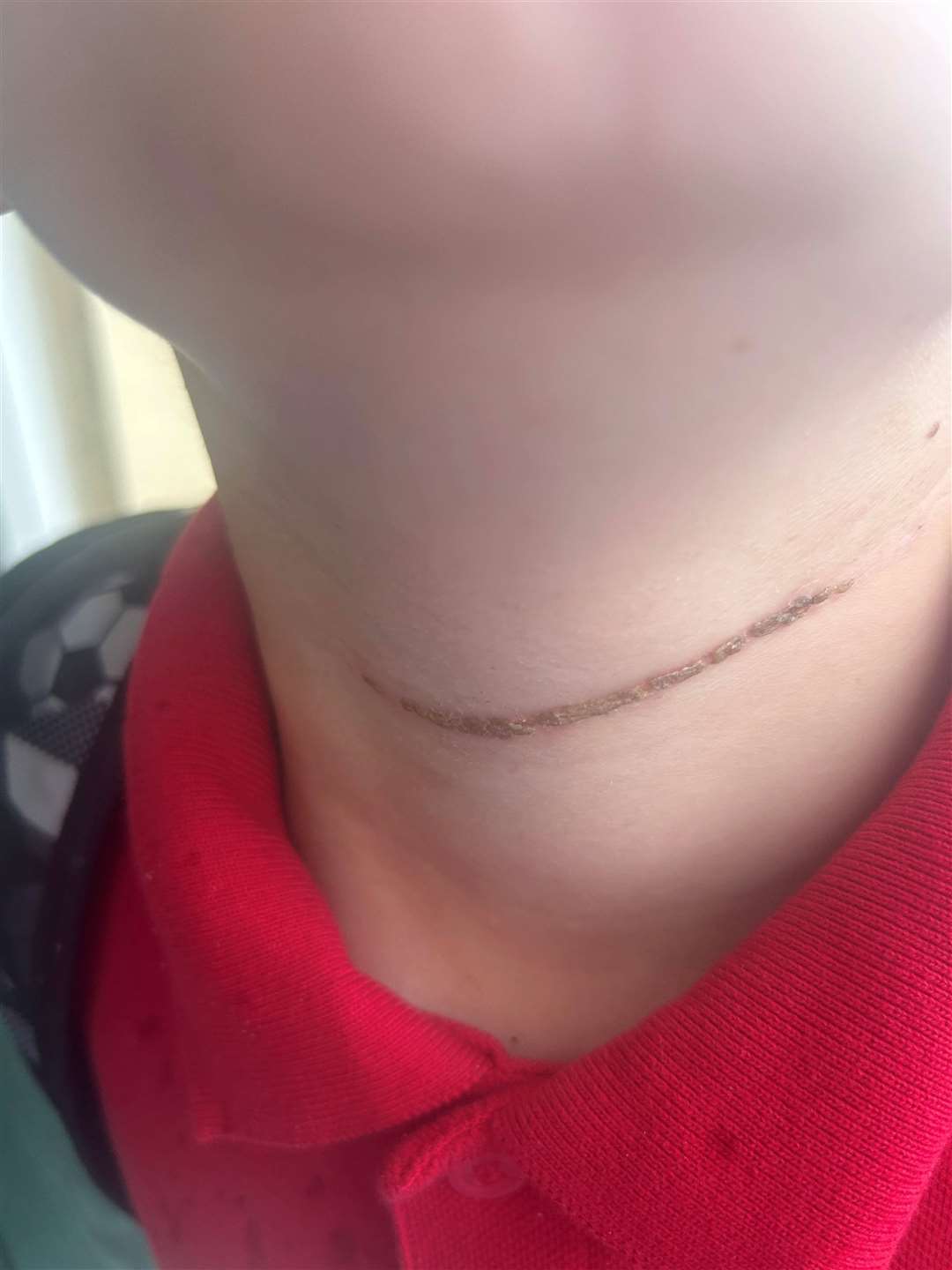 Franki is now healing well.