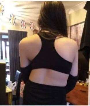 Eleanor is hoping she can undergo private treatment for problems with her spine. (49124779)