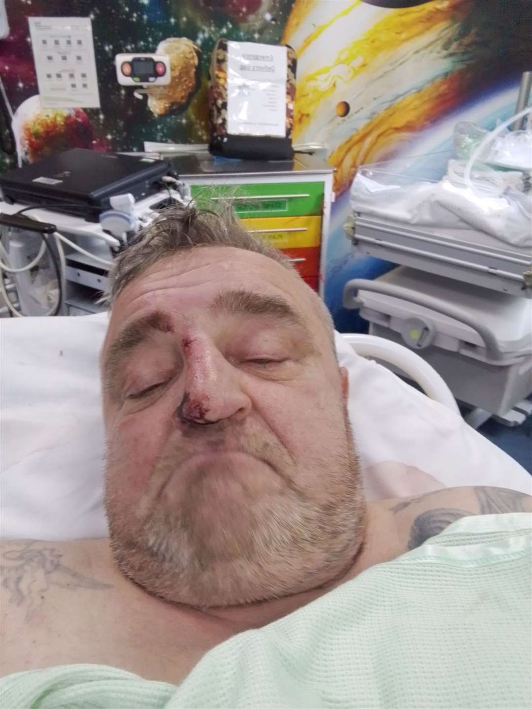 Zbigniew Prokopyszyn from Wisbech has described the agony is suffering after being hit by a lorry on a zebra crossing. (63031309)