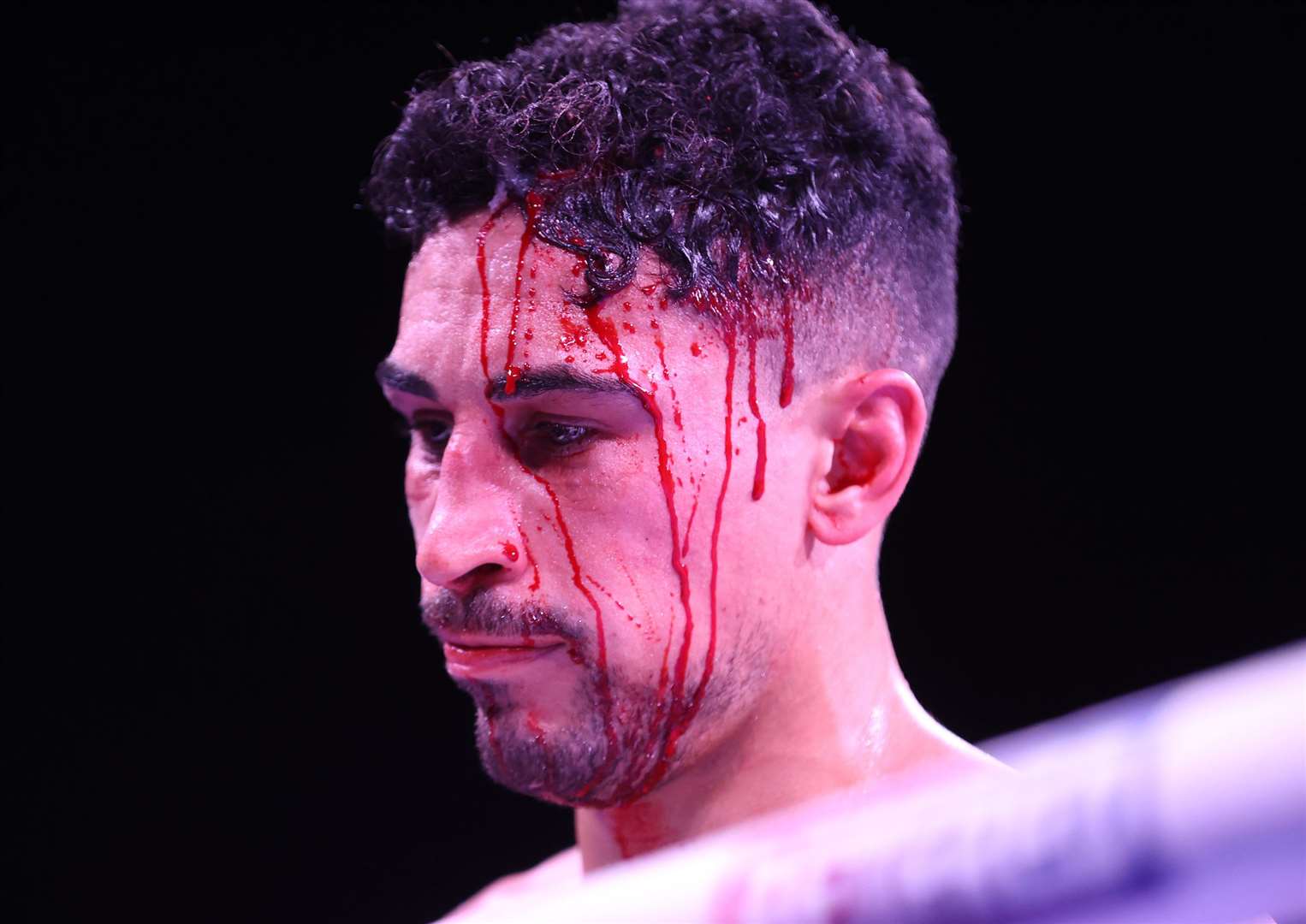 Blood pours from Jordan Gill's wound.Photo: Mark Robinson (Matchroom Boxing)