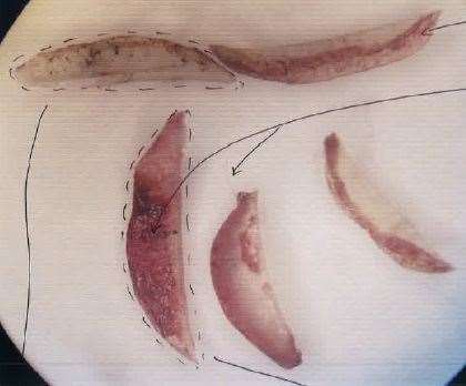 Fingernail clippings containing Newton's DNA taken from Una Crown's right hand