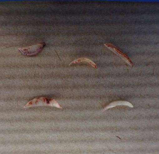 The fingernail clippings taken from Una Crown’s right hand, where Newton’s DNA was found